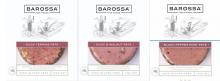 Photograph of Barossa Fine Foods Pates 110g